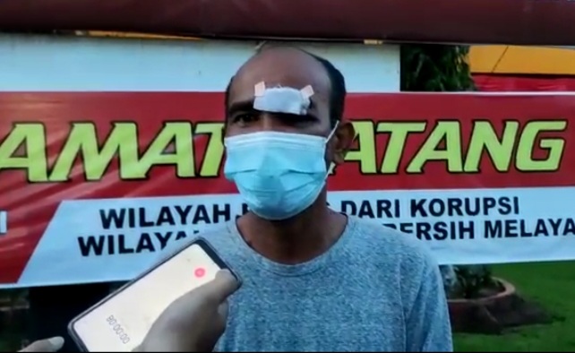 Datangi Polresta Padang, Pria yang Viral dengan Muka Berdarah di Pos PPKM Darurat Minta Maaf