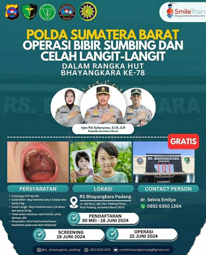 Meriahkan HUT Bhayangkara ke-78, Polda Sumbar gelar Bakti Sosial Operasi Bibir Sumbing Gratis 
