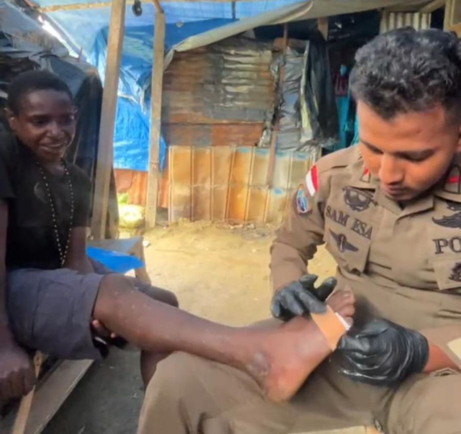 Personel Ops Damai Cartenz 2025 Beri Pengobatan kepada Anak yang Terluka di Intan Jaya